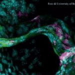 Membrana SLYM: La scoperta del quarto e “nuovo” strato che protegge il cervello